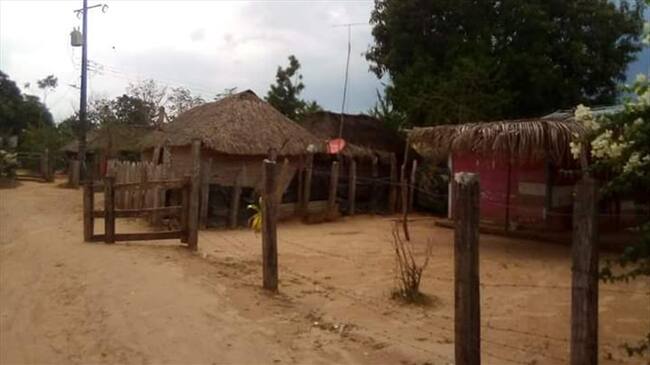 Autoridades investigan caso de una joven que fue quemada con agua caliente. Foto: cortesía