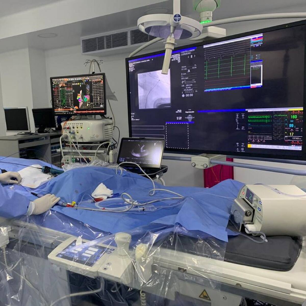 Montería: realizaron implantación de válvula pulmonar, primera de la región Caribe