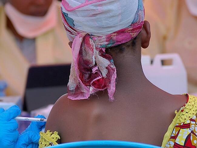 Así son los tratamientos más efectivos para tratar el ébola