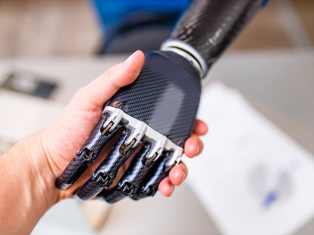 Karol Bastidas, deportista que sueña con manos biónicas para seguir inspirando al mundo