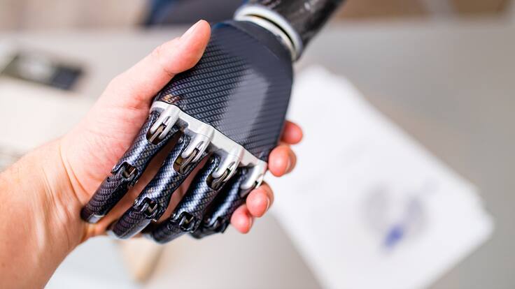 Karol Bastidas, deportista que sueña con 2 manos biónicas para seguir inspirando al mundo