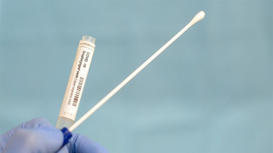 Pruebas PCR contra COVID-19. Foto: Paul Biris / Getty Images