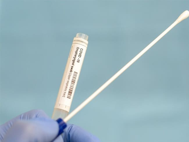 Pruebas PCR contra COVID-19. Foto: Paul Biris / Getty Images