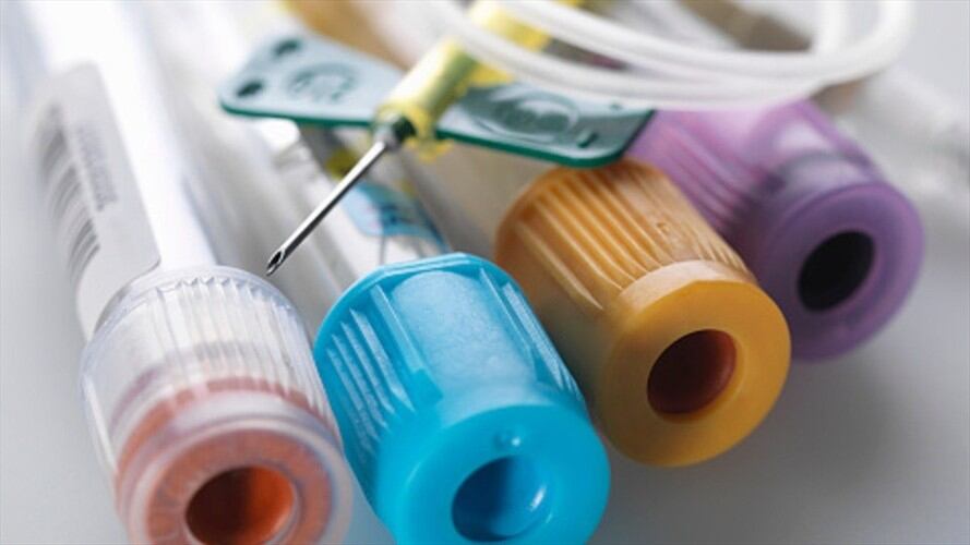 Un equipo de científicos de la Universidad de Zurich y la Universidad Hospital de Zurich ha investigado los factores que llevan a algunas personas contagiadas con VIH.. Foto: Getty Images