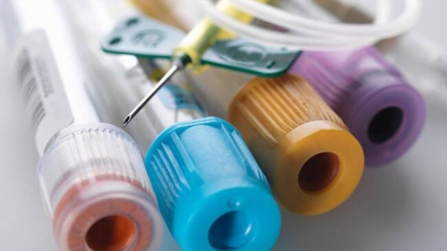 Un equipo de científicos de la Universidad de Zurich y la Universidad Hospital de Zurich ha investigado los factores que llevan a algunas personas contagiadas con VIH.. Foto: Getty Images