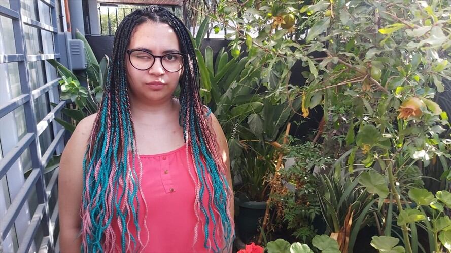 La tragedia que viven los más de 400 afectados oculares por protestas en Chile. Foto: Agencia Anadolu