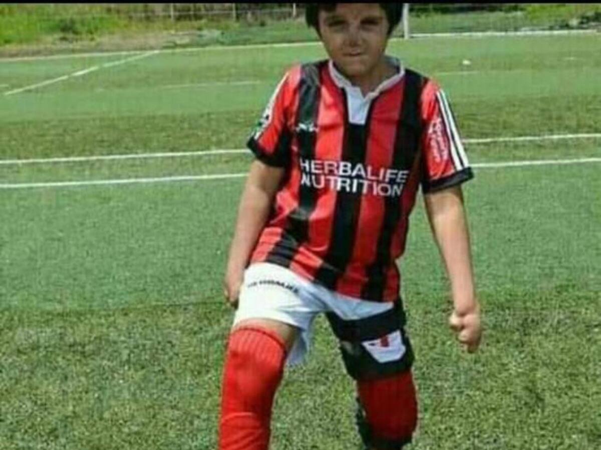 Un joven pereirano busca apoyo para acceder a la prótesis OTP de su pierna