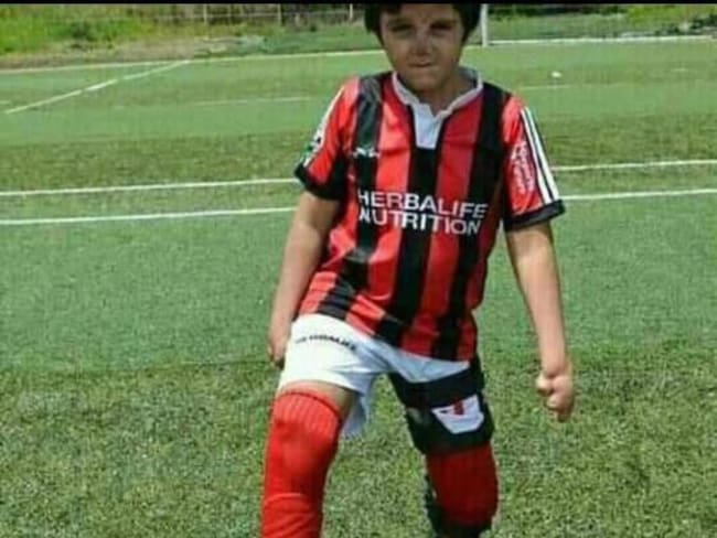 El menor requiere prótesis para movilizarse / Foto: Suministrada familia