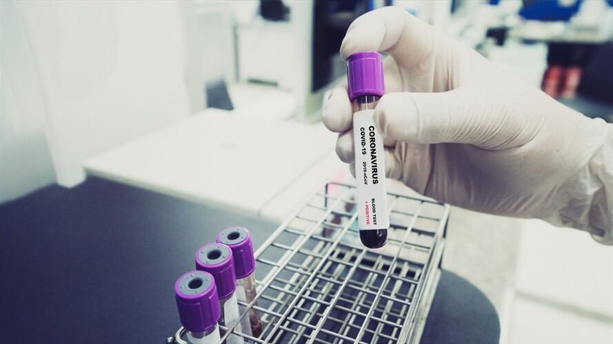 Casos de Coronavirus en Colombia. Foto: Getty Images