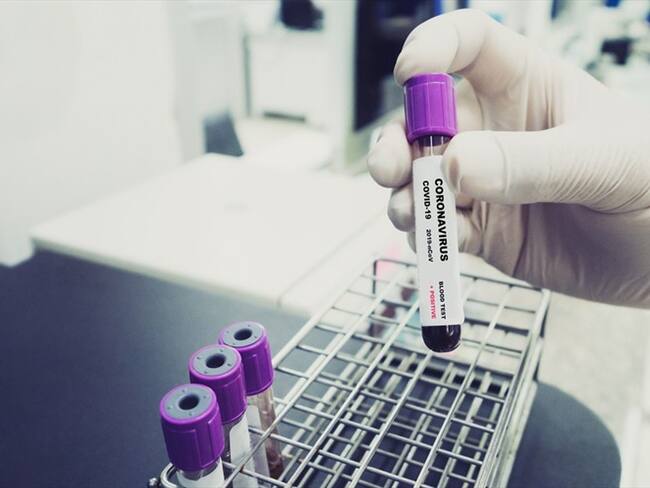 Casos de Coronavirus en Colombia. Foto: Getty Images