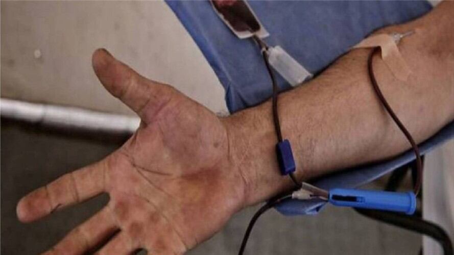 Donación Sangre. Foto: HUS.