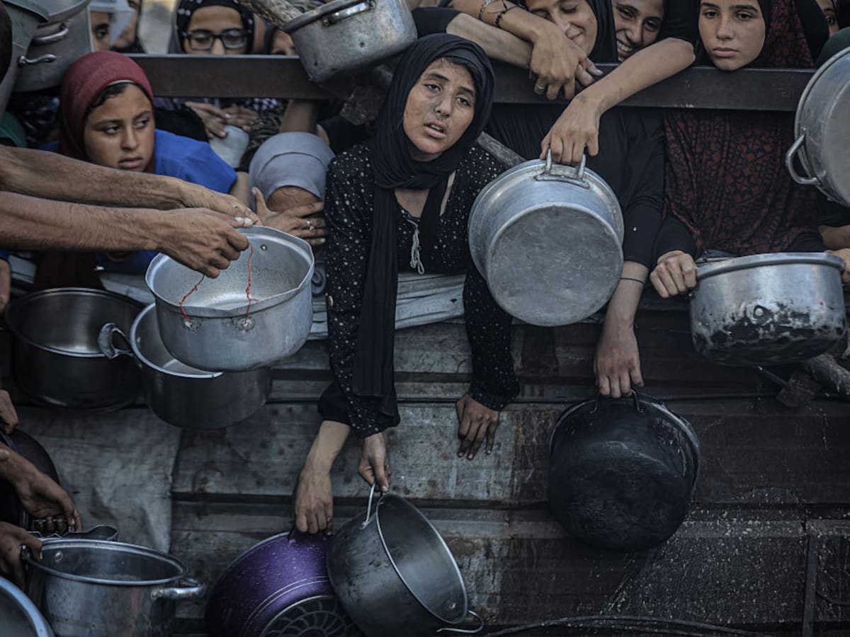 Murió en Italia por desnutrición una joven palestina evacuada desde Gaza 48 horas antes