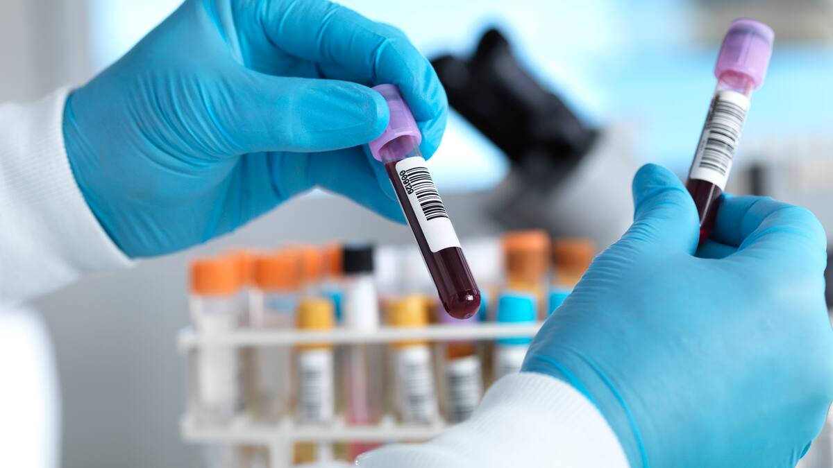 Análisis de sangre podría sustituir la colonoscopía para la detección del cáncer de colon