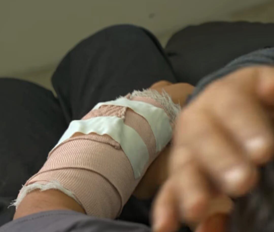 Las autoridades señalaron que las afectaciones por pólvora no solamente dejan impactos físicos, sino también psicológicos. Crédito: Secretaría Departamental de Salud del Cauca.