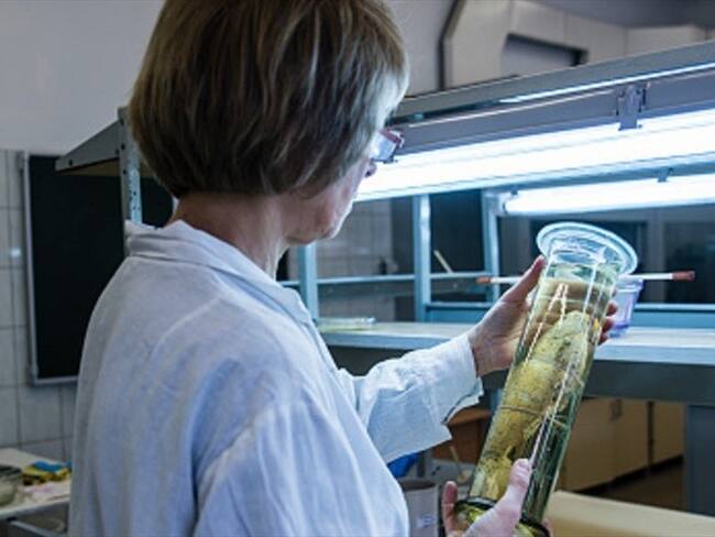 Así es el museo de patologías humanas en Londres