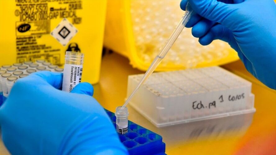 Procuraduría reclama a INS por resultados de COVID-19 en el Amazonas. Foto: Getty Images