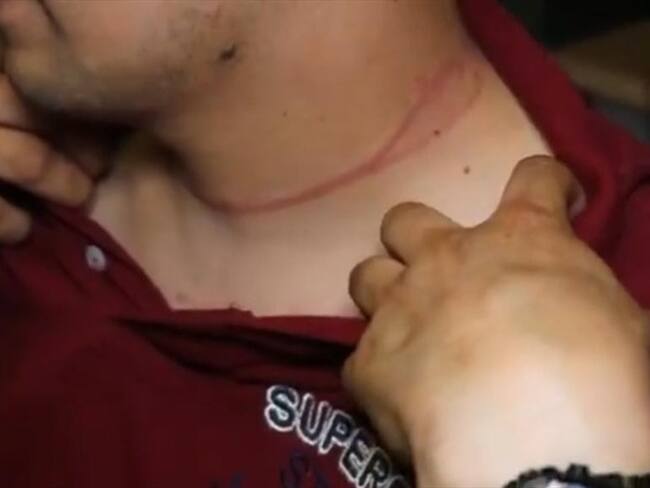 El uniformado presenta varias lesiones, una de ellas en su cuello.. Foto: Policía Nacional