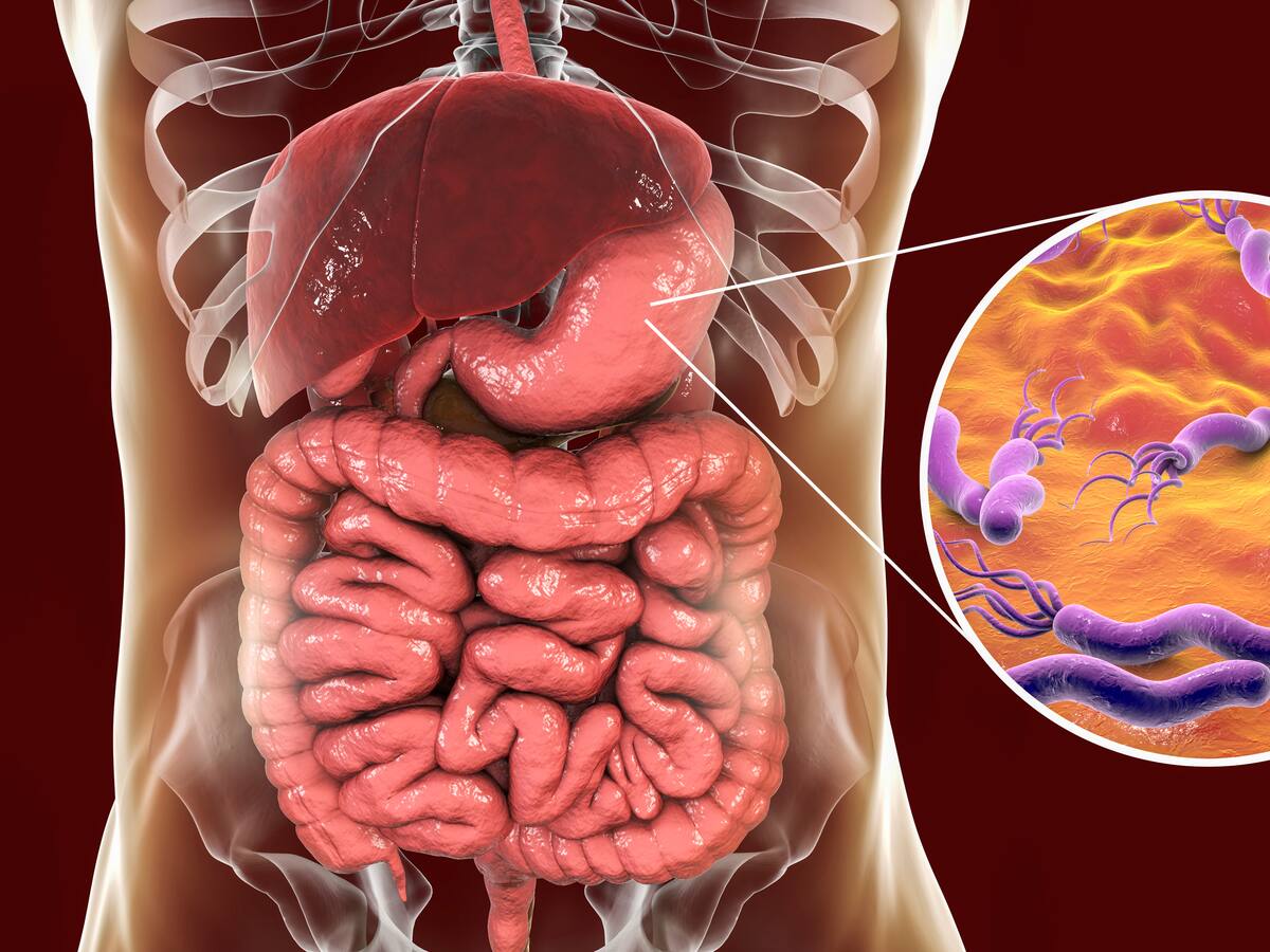 ¿Cómo prevenir el cáncer de estómago? Experta dio algunos síntomas de esta enfermedad