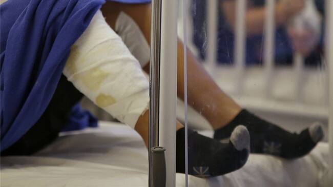 Lanzan campaña para evitar quemados durante festividades navideñas en La Calera. Foto: Colprensa - Álvaro Tavera