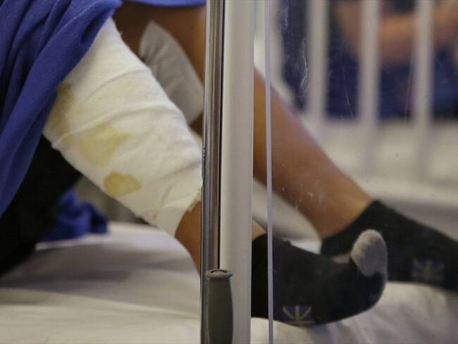 Lanzan campaña para evitar quemados durante festividades navideñas en La Calera. Foto: Colprensa - Álvaro Tavera