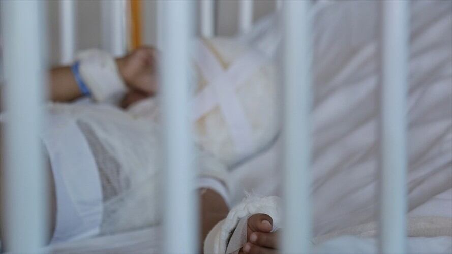 Las autoridades departamentales informaron que la cifra de quemados con pólvora disminuyó con respecto al año anterior. Foto: Colprensa