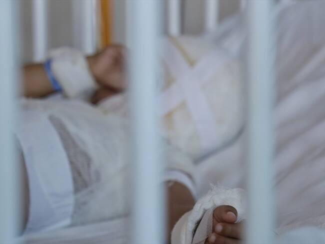 Las autoridades departamentales informaron que la cifra de quemados con pólvora disminuyó con respecto al año anterior. Foto: Colprensa