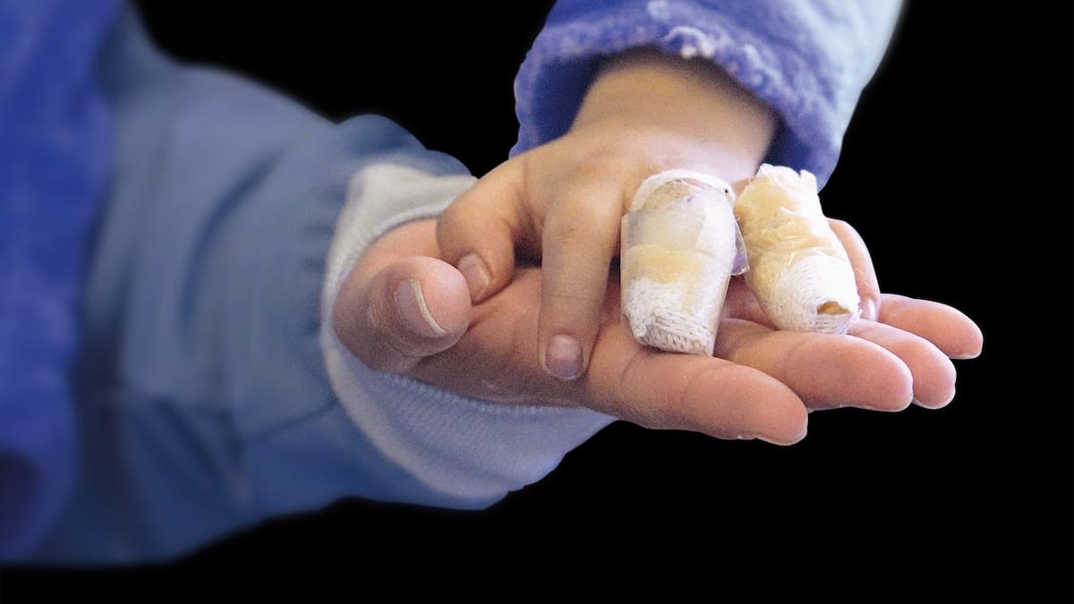 Buenas noticias para Bogotá: bajó la cifra de quemados con pólvora, ¿Qué medidas se tomaron?