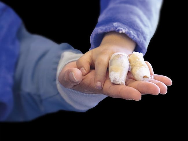 Buenas noticias para Bogotá: bajó la cifra de quemados con pólvora, ¿Qué medidas se tomaron?