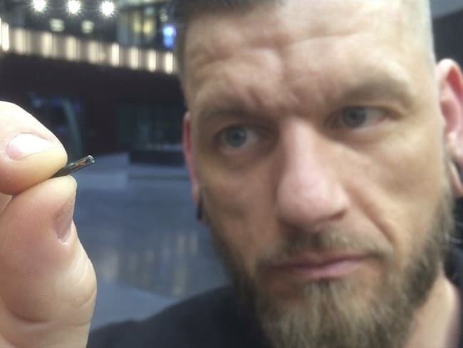 Firma sueca coloca microchip a empleados. Foto: Associated Press - AP