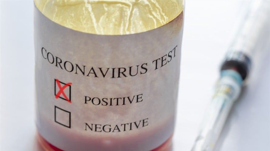 Imagen de referencia. Foto: Getty Images