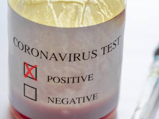 Imagen de referencia. Foto: Getty Images