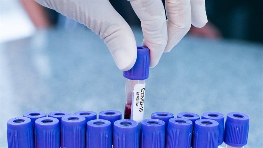 Los casos recuperados de COVID-19 reportados hoy son 7.705 para un total de 1.197.204 que han superado esta enfermedad. Foto: Getty Images