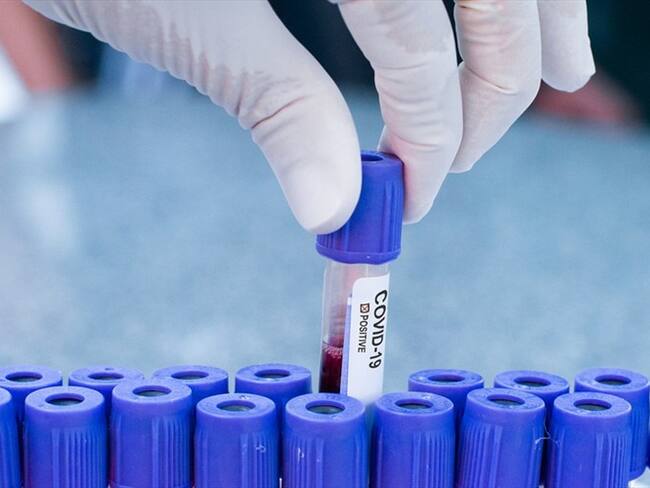 Los casos recuperados de COVID-19 reportados hoy son 7.705 para un total de 1.197.204 que han superado esta enfermedad. Foto: Getty Images