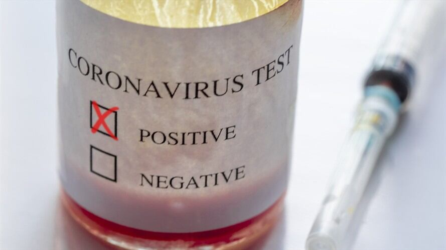 Imagen de referencia. Foto: Getty Images