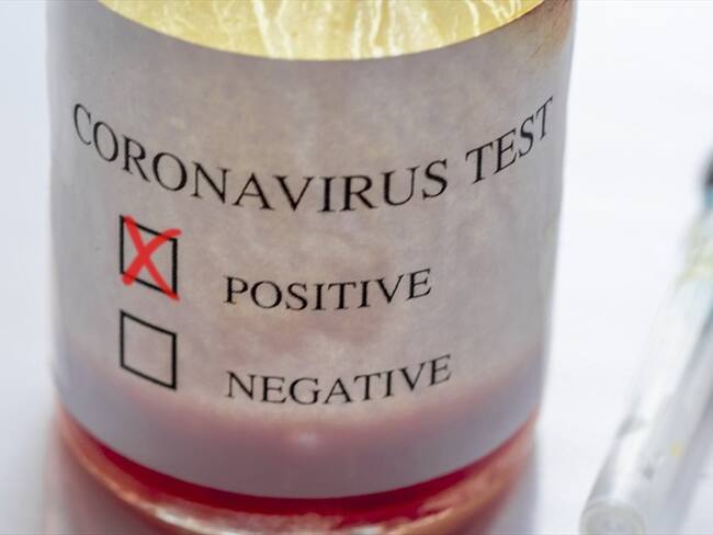 Imagen de referencia. Foto: Getty Images