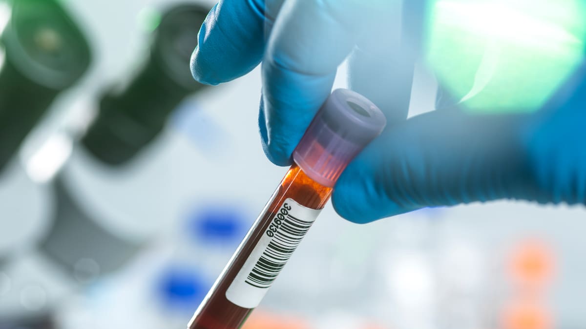 Reforma a la salud pondría en riesgo atención de los pacientes con VIH