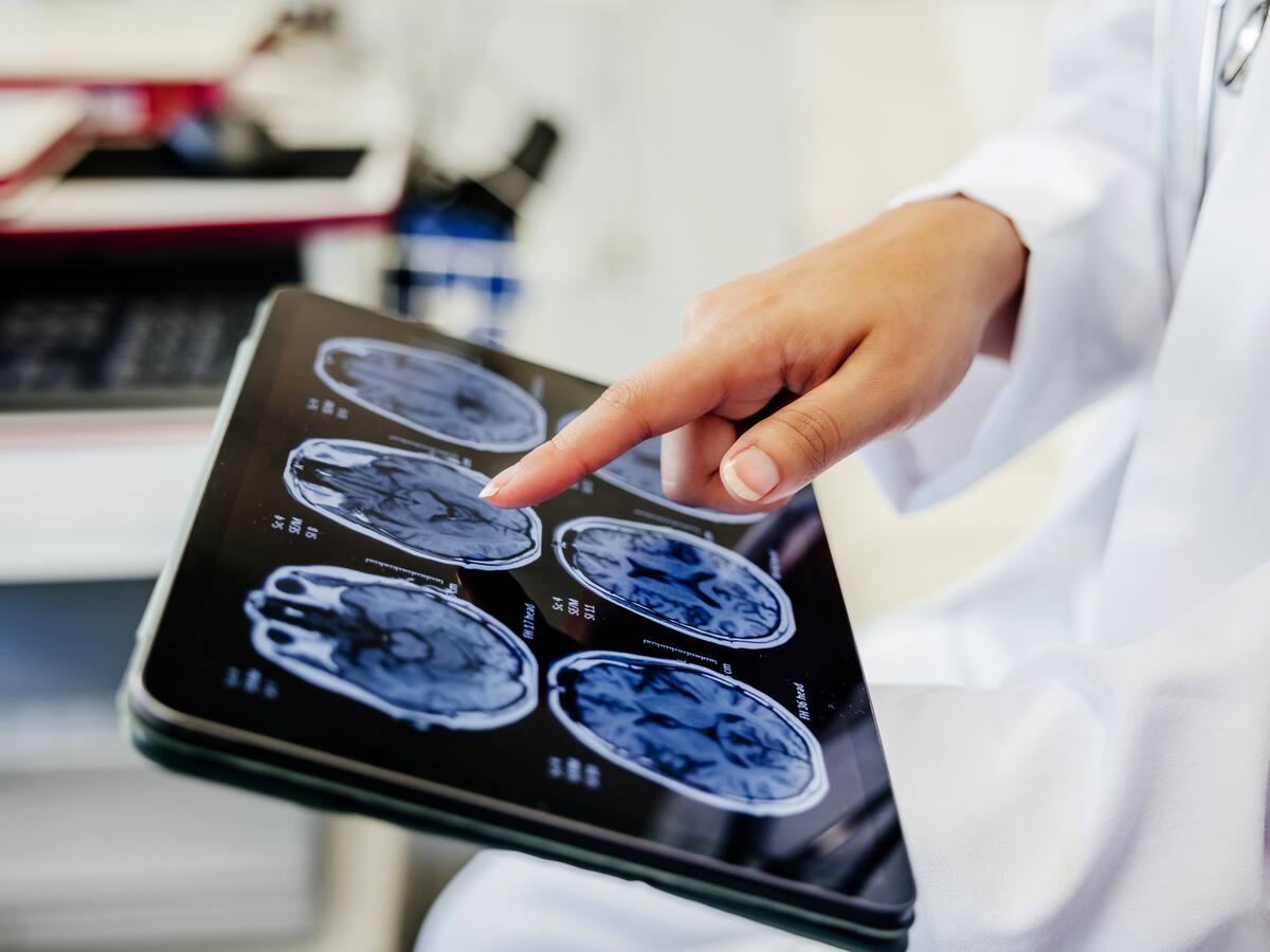 ¿Qué pueden generar los microplásticos en el cerebro? Neurólogo alerta sobre graves consecuencias