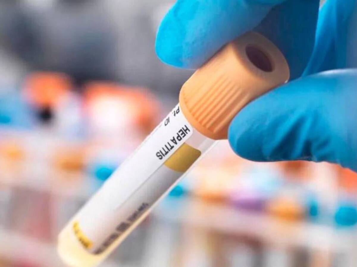 Autoridades de salud de Dosquebradas alertan aumento de casos de Hepatitis A