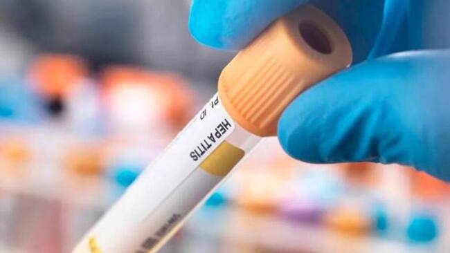 Alera por Hepatitis A en Dosquebradas, Risaralda / Foto: Getty Images