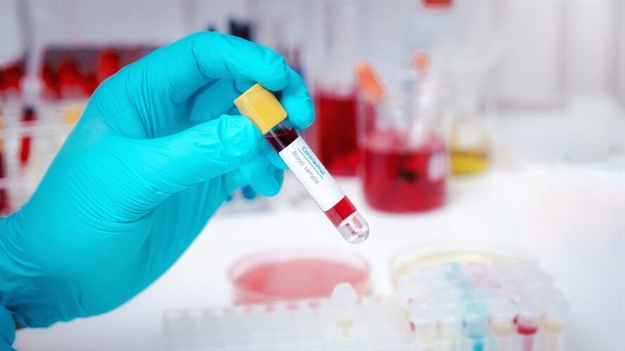Los investigadores evaluaron los primeros resultados en los donantes, los pacientes y en un grupo sin infección COVID-19. Foto: Getty Images / Skarie20