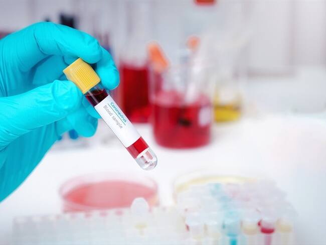 Los investigadores evaluaron los primeros resultados en los donantes, los pacientes y en un grupo sin infección COVID-19. Foto: Getty Images / Skarie20