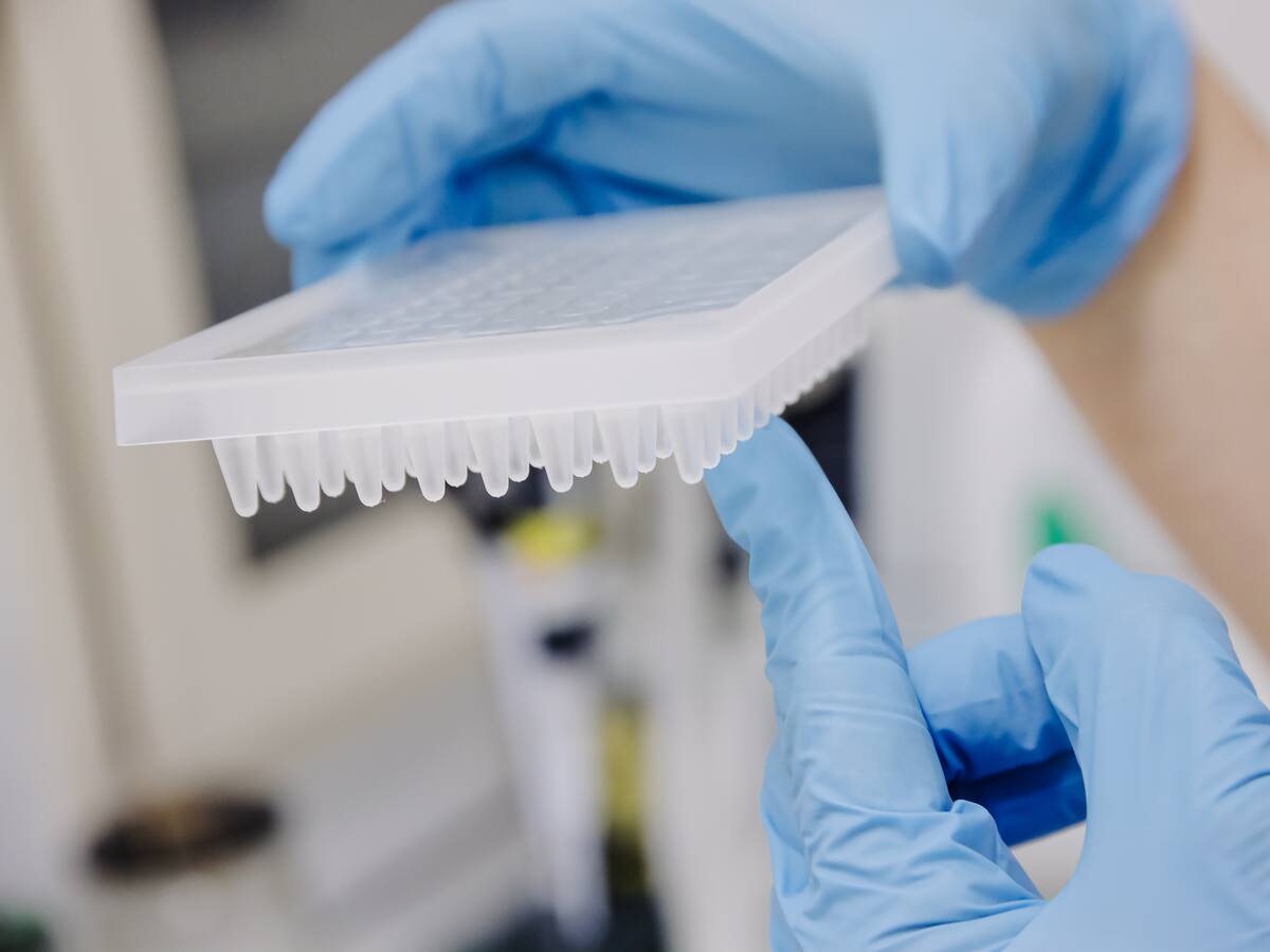 Suben a 44 los casos confirmados de viruela del mono en Alemania