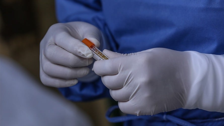 Por ahora se desconoce la identidad del hombre, a quien los médicos le salvaron la vida.. Foto: Colprensa