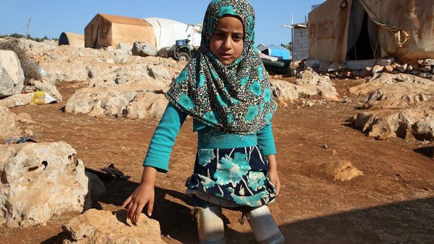La niña siria que usa latas en lugar de prótesis. Foto: Agencia Anadolu