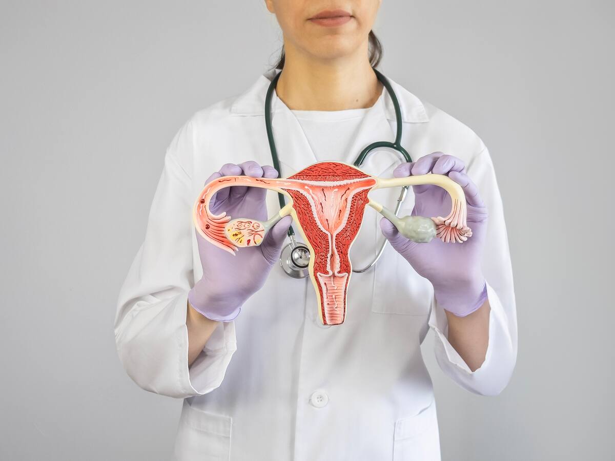 Miomatosis uterina: ¿qué es y cómo afecta a las mujeres?