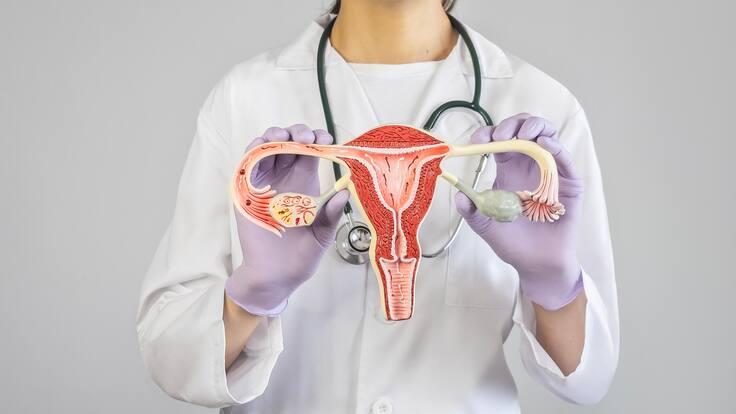 Miomatosis uterina: ¿qué es y cómo afecta a las mujeres?