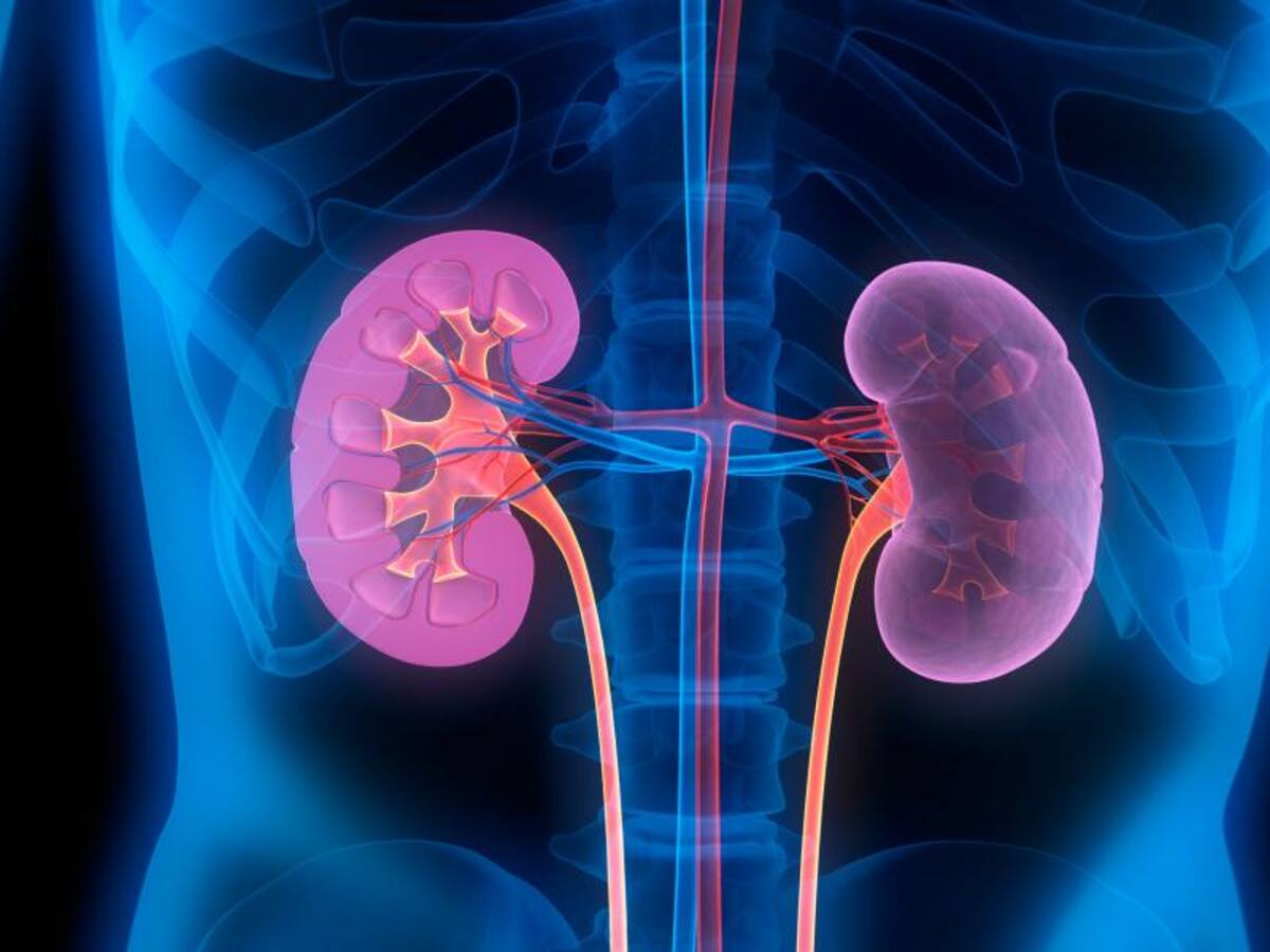 Enfermedad renal crónica: ¿cuáles son sus causas? Señales de riesgo y recomendaciones, según experta