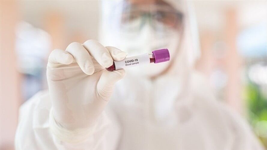 Las autoridades trabajan en el cerco epidemiológico.. Foto: Getty Images