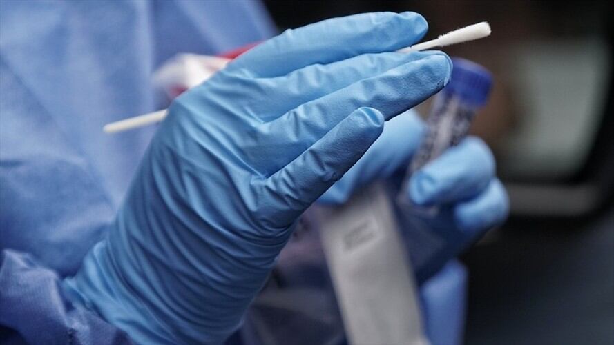 Casos de COVID-19 en Colombia. Foto: Colprensa