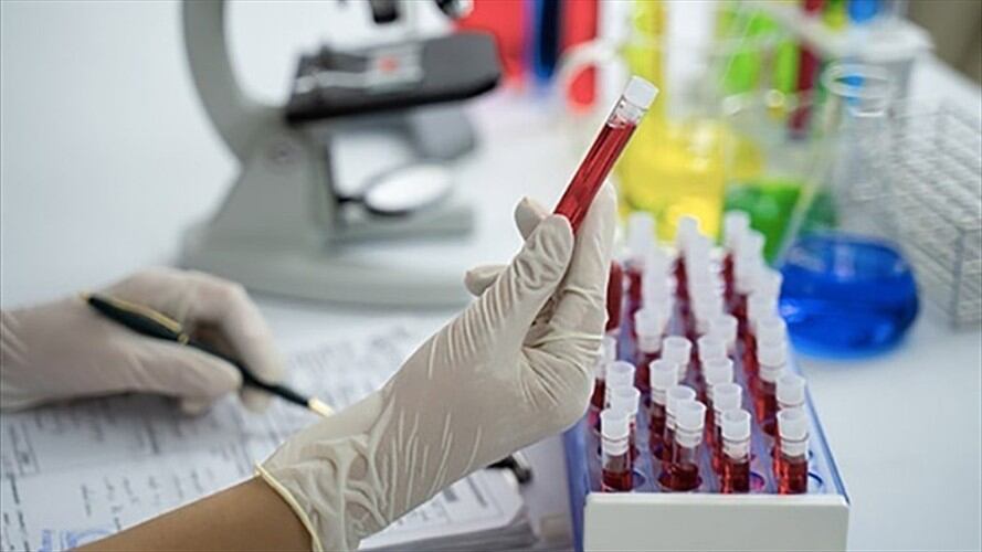 En consecuencia, a la fecha, sumando los 10 profesionales de la salud, se han reportado 88 pacientes con casos positivos, y 35 se encuentran recuperados.. Foto: Getty Images